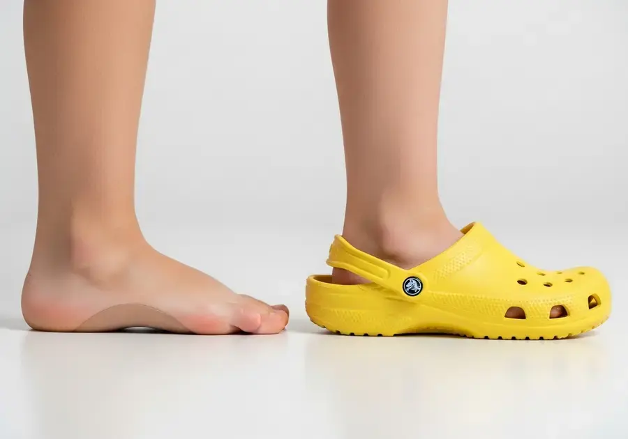 Impactos Negativos dos Crocs no Desenvolvimento dos Pés Impactos Negativos dos Crocs no Desenvolvimento dos Pés